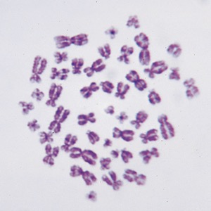사람염색체(영구프레파라트) KSIC-6134